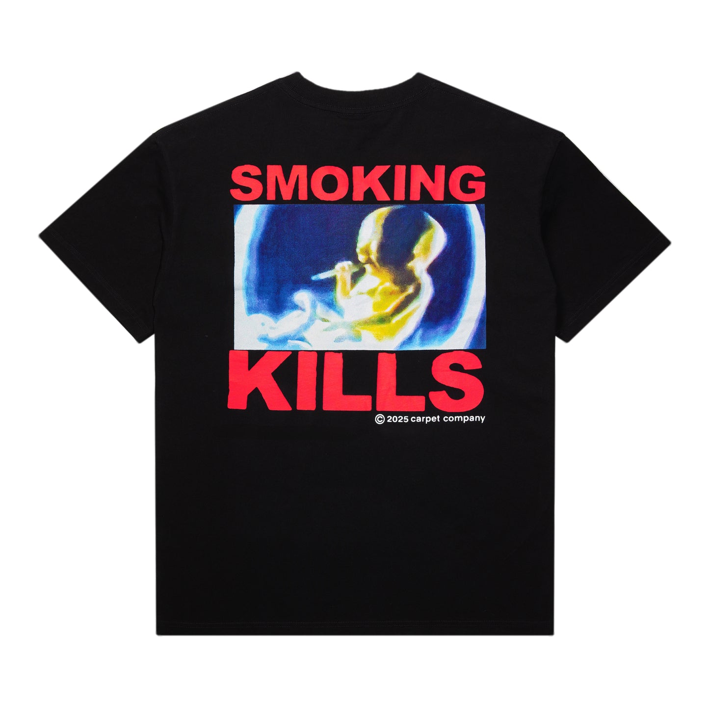 Smoking Kills Tee